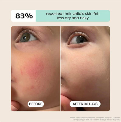 Baby Bath Tub Filter